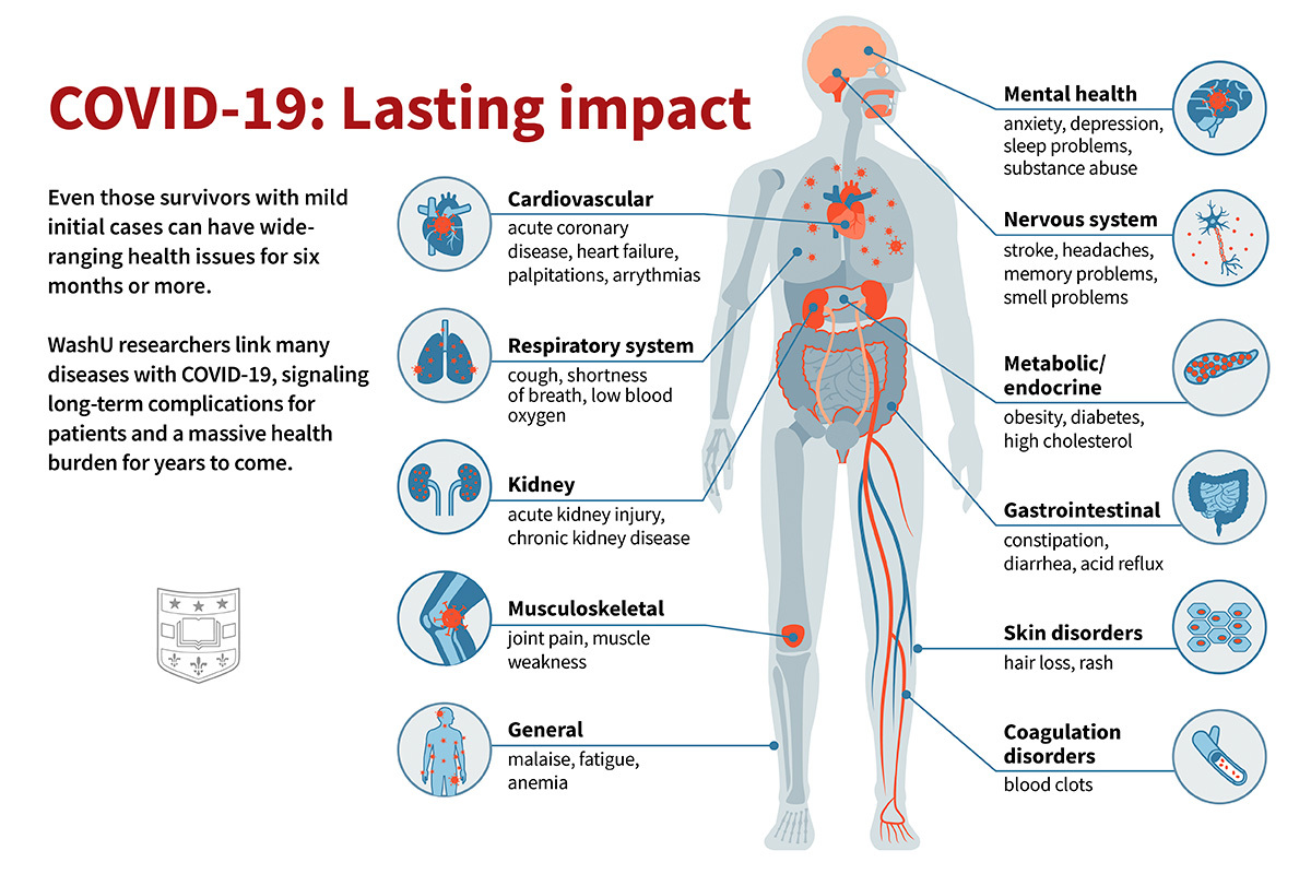 COVID-19 Vaccines And The Reduced Risk Of Long COVID: A Comprehensive Review COVID-19 Vaccines And The Reduced Risk Of Long COVID: A Comprehensive Review