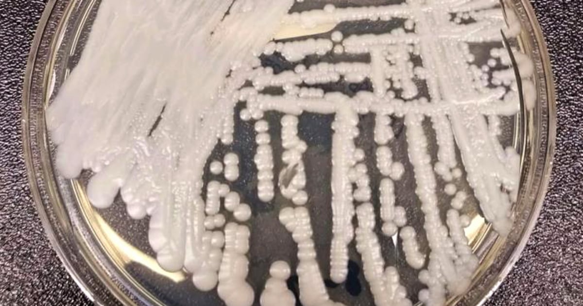 Deadly Fungi: The Impact Of Global Warming On Fungal Infections Deadly Fungi: The Impact Of Global Warming On Fungal Infections