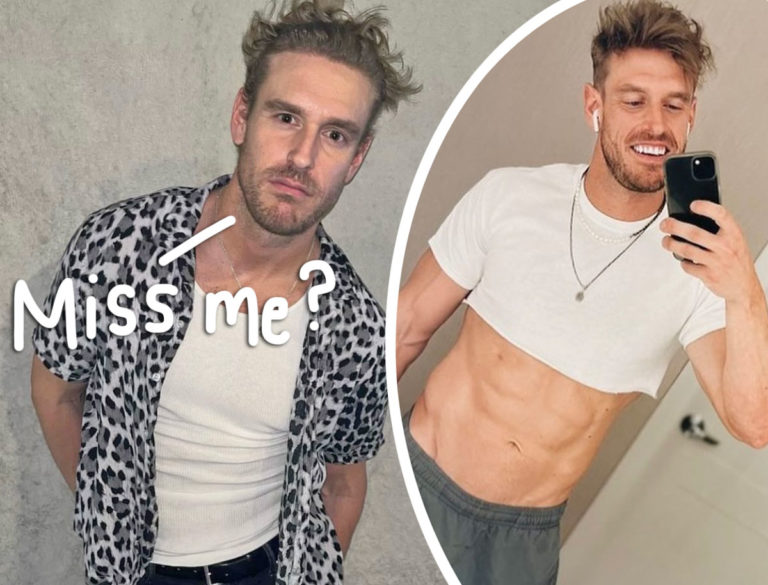 Facelifts: Fan Concerns Over Celebrity's Changed Appearance Facelifts: Fan Concerns Over Celebrity's Changed Appearance