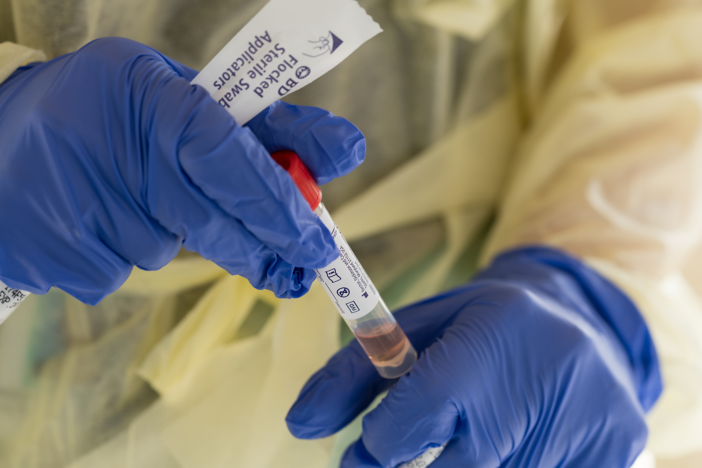 Fraudulent COVID-19 Testing: Lab Owner's Guilty Plea Fraudulent COVID-19 Testing: Lab Owner's Guilty Plea