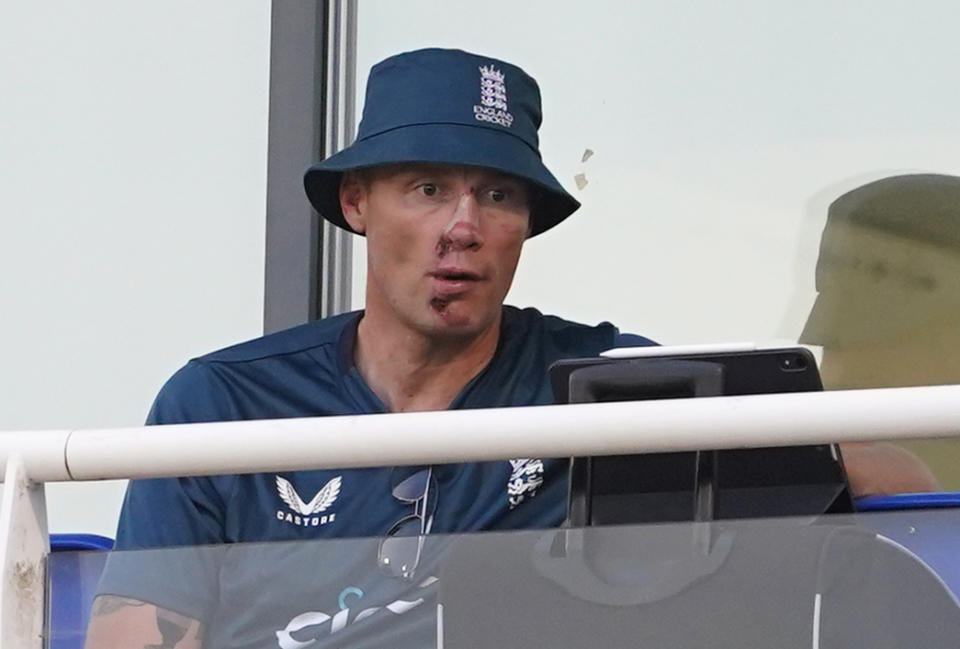 Freddie Flintoff Confirms Disney+ Documentary About His Crash Freddie Flintoff Confirms Disney+ Documentary About His Crash