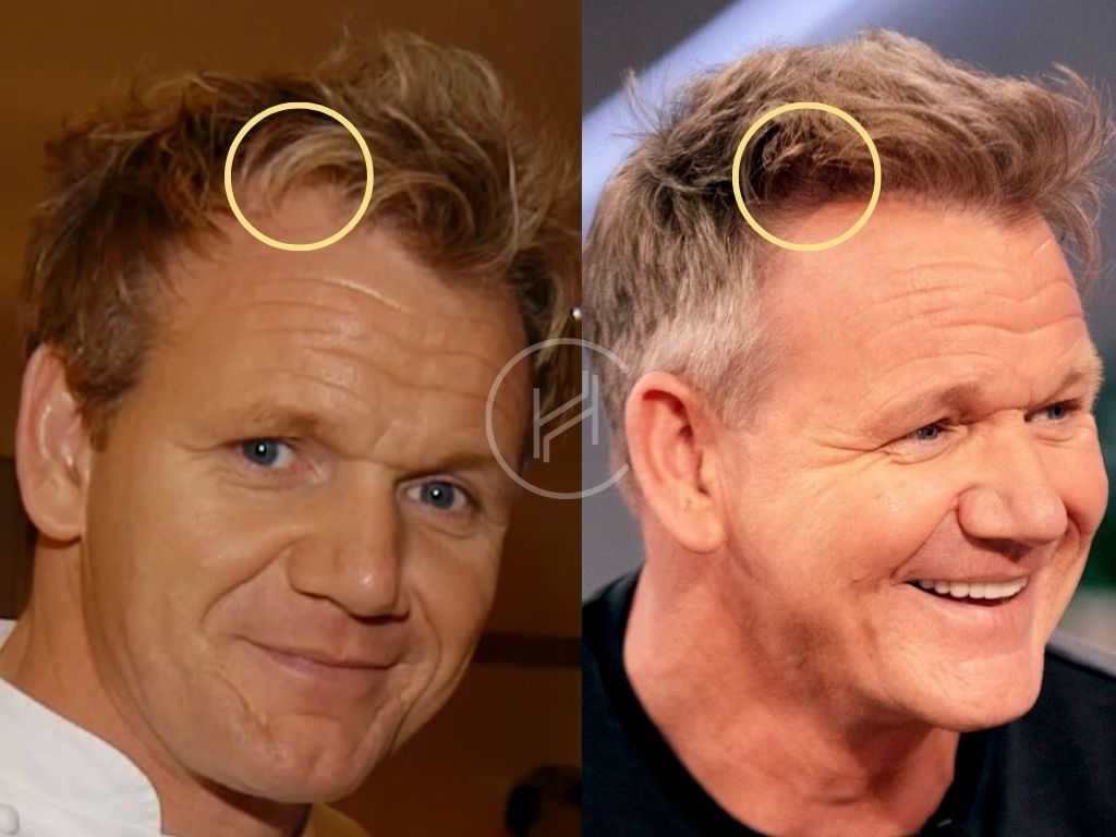 Gordon Ramsay: Chandler's Loss To Pimblett Not A Surprise