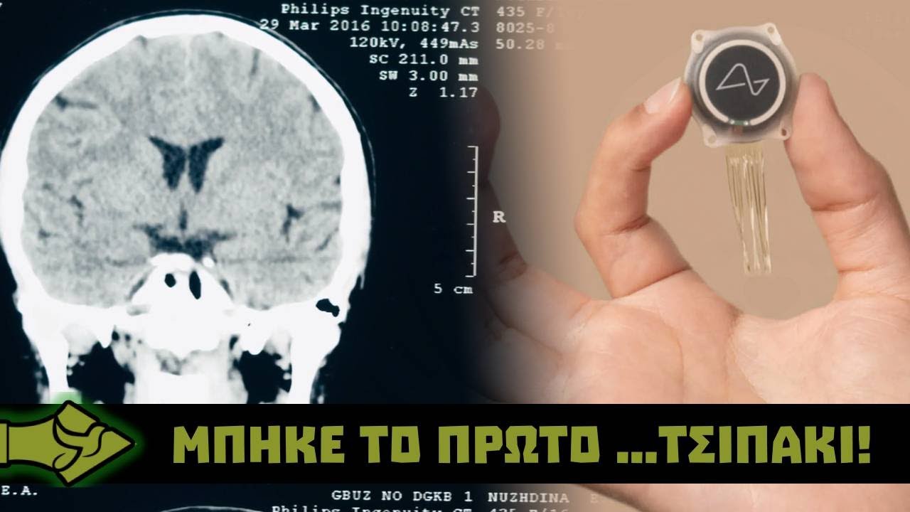 Η Αποχώρηση Του Ίλον Μασκ Από Την Κυβέρνηση Τραμπ Και Η Κριτική Του Στο Νομοσχέδιο Η Αποχώρηση Του Ίλον Μασκ Από Την Κυβέρνηση Τραμπ Και Η Κριτική Του Στο Νομοσχέδιο
