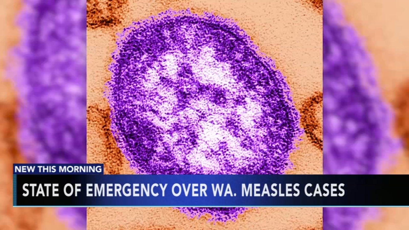 Israel Faces Measles Outbreak After Texas Cases Reported Israel Faces Measles Outbreak After Texas Cases Reported