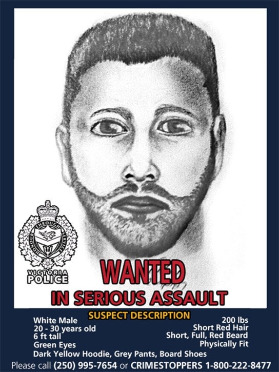Man Shot On Beacon Hill; Police Seek Information Man Shot On Beacon Hill; Police Seek Information