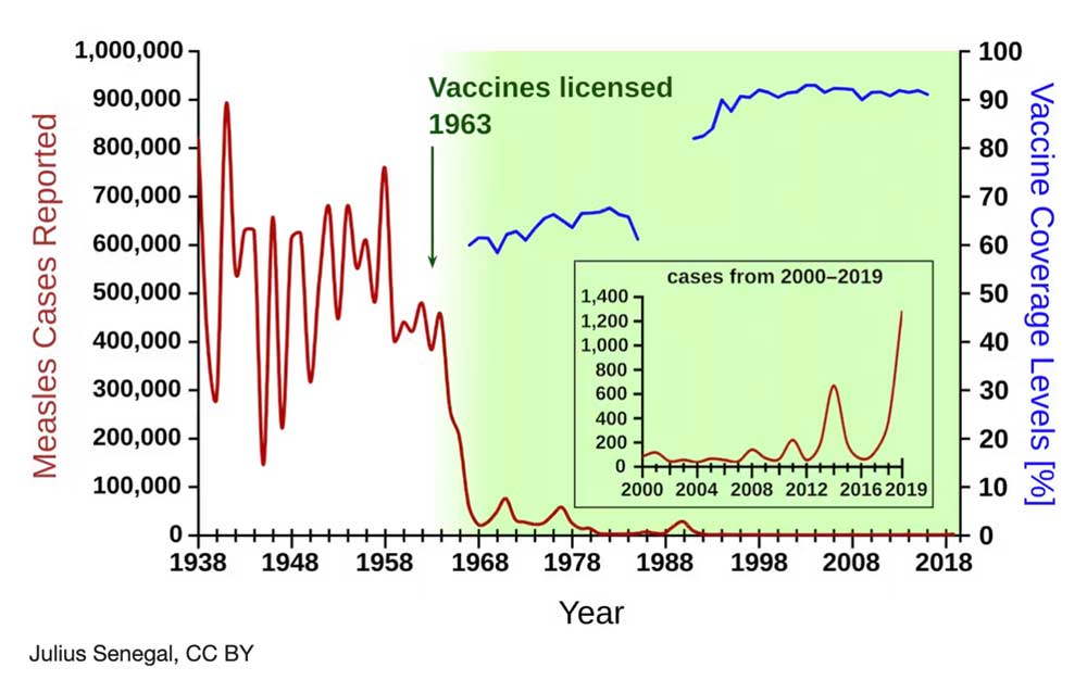 Measles Cases In The US Rise To 1,046: Indiana Outbreak Concludes Measles Cases In The US Rise To 1,046: Indiana Outbreak Concludes