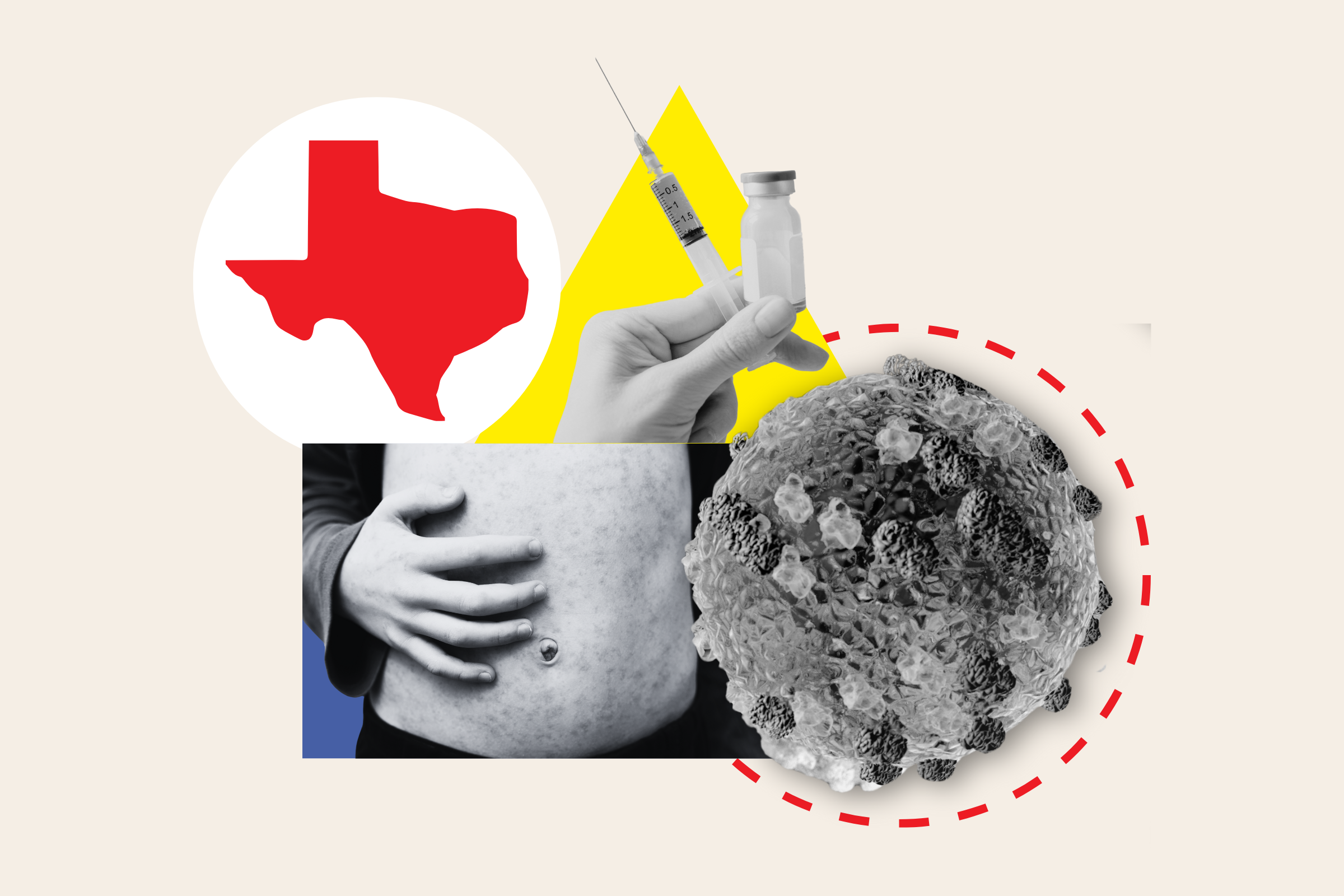 Measles In Texas: Separate Clusters Contribute To Statewide Increase Measles In Texas: Separate Clusters Contribute To Statewide Increase