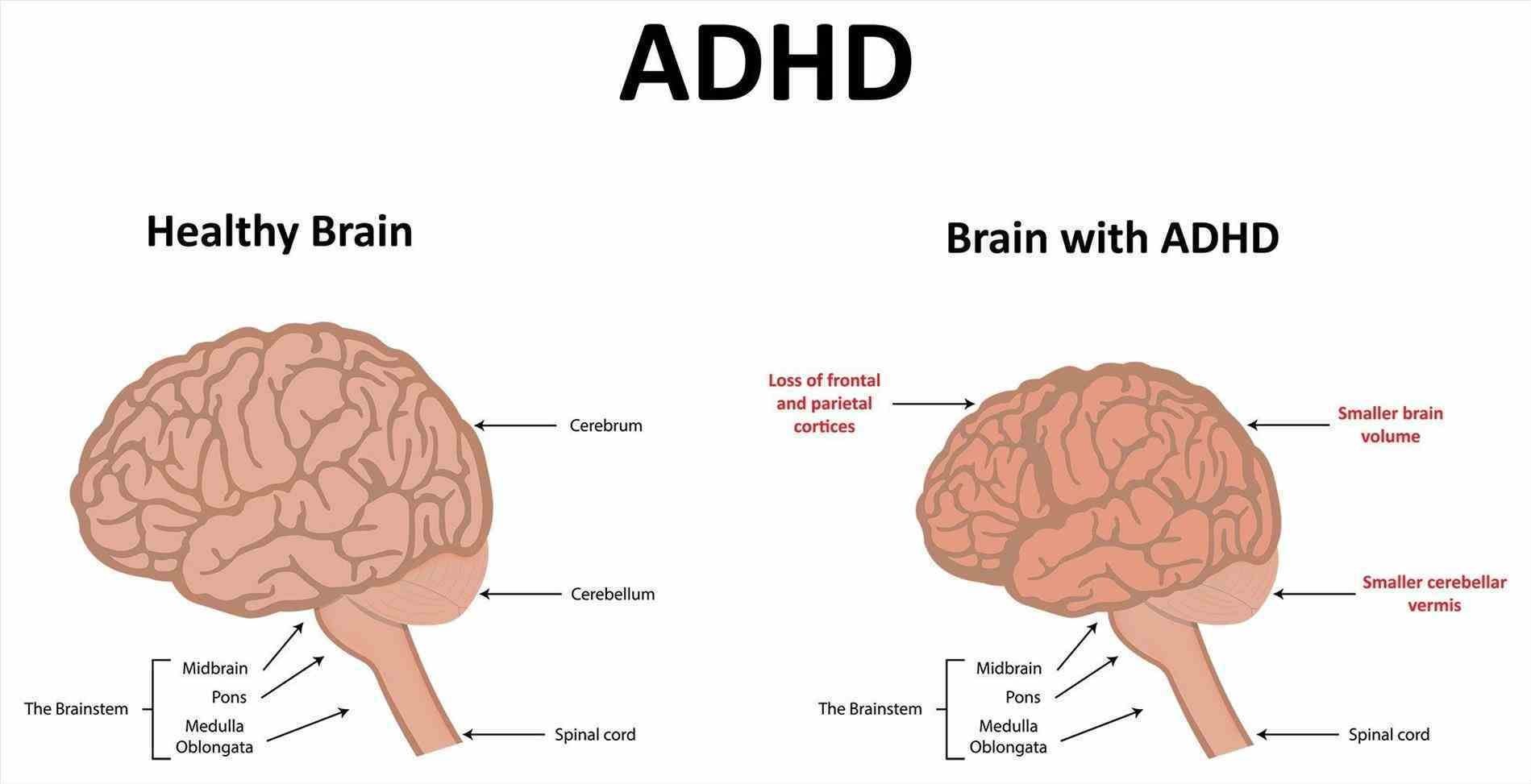 Navigating Life With ADHD: An Inside Look At Our ADHD Minds Navigating Life With ADHD: An Inside Look At Our ADHD Minds