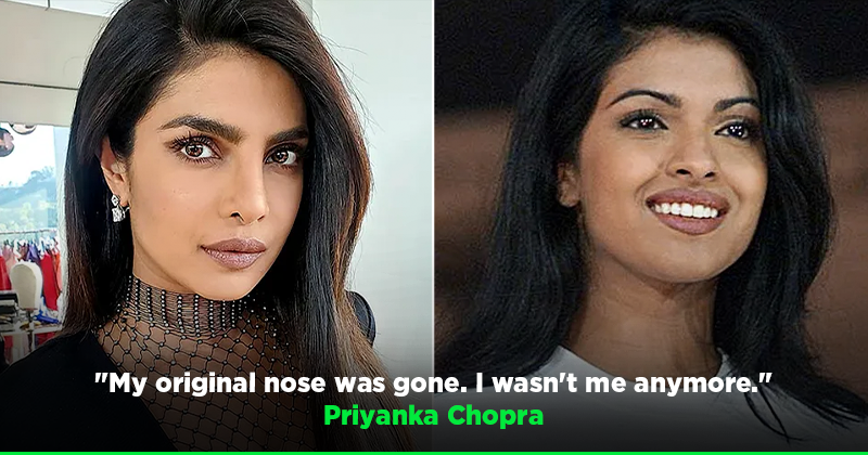 Priyanka Chopra's Nose Job: Her Father's Response Priyanka Chopra's Nose Job: Her Father's Response