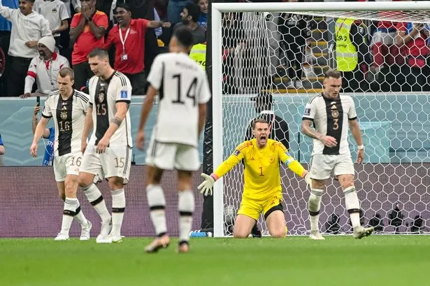 The Severity Of Neuer's Injury And Its Implications For Bayern The Severity Of Neuer's Injury And Its Implications For Bayern