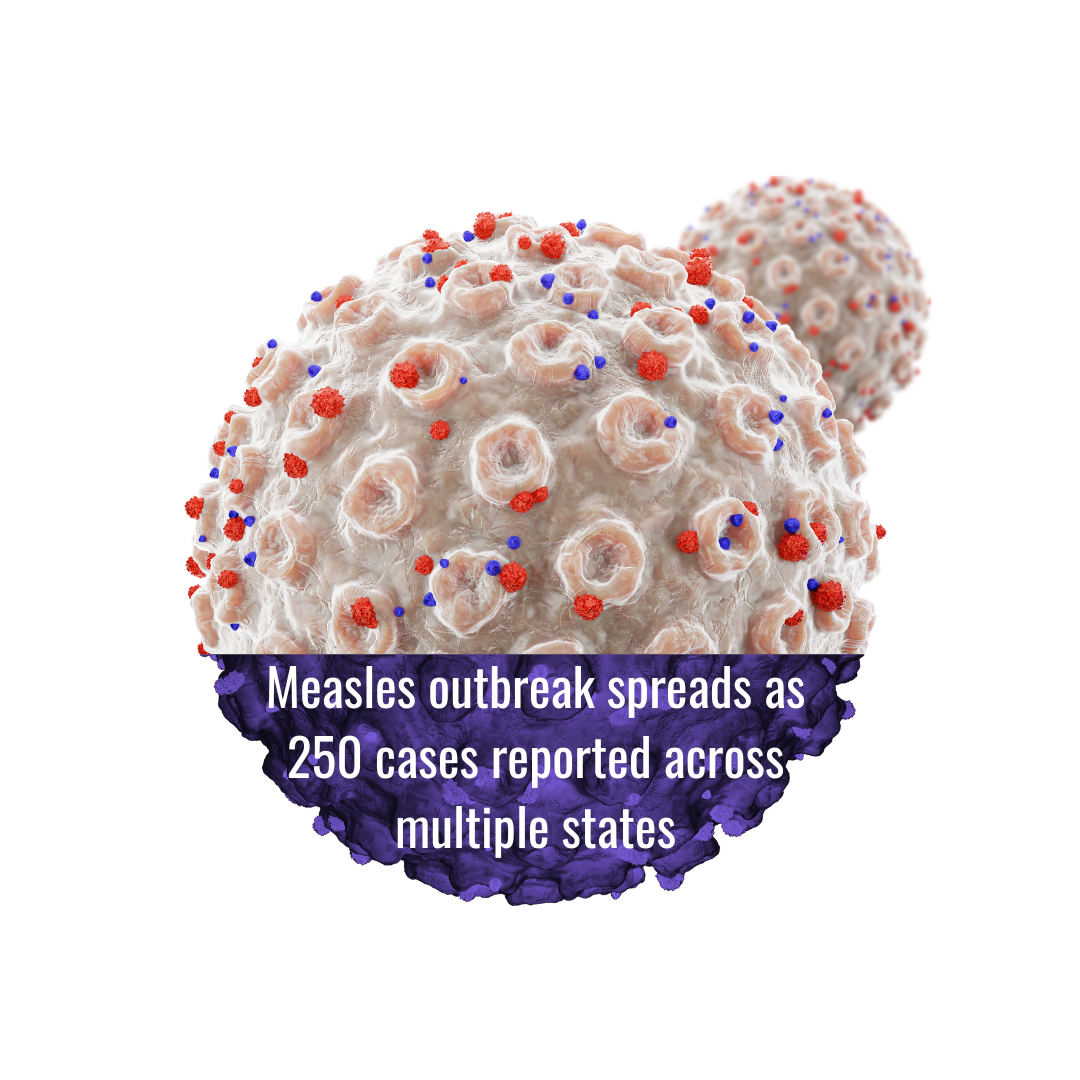 Understanding The Current Measles Outbreak In The United States Understanding The Current Measles Outbreak In The United States