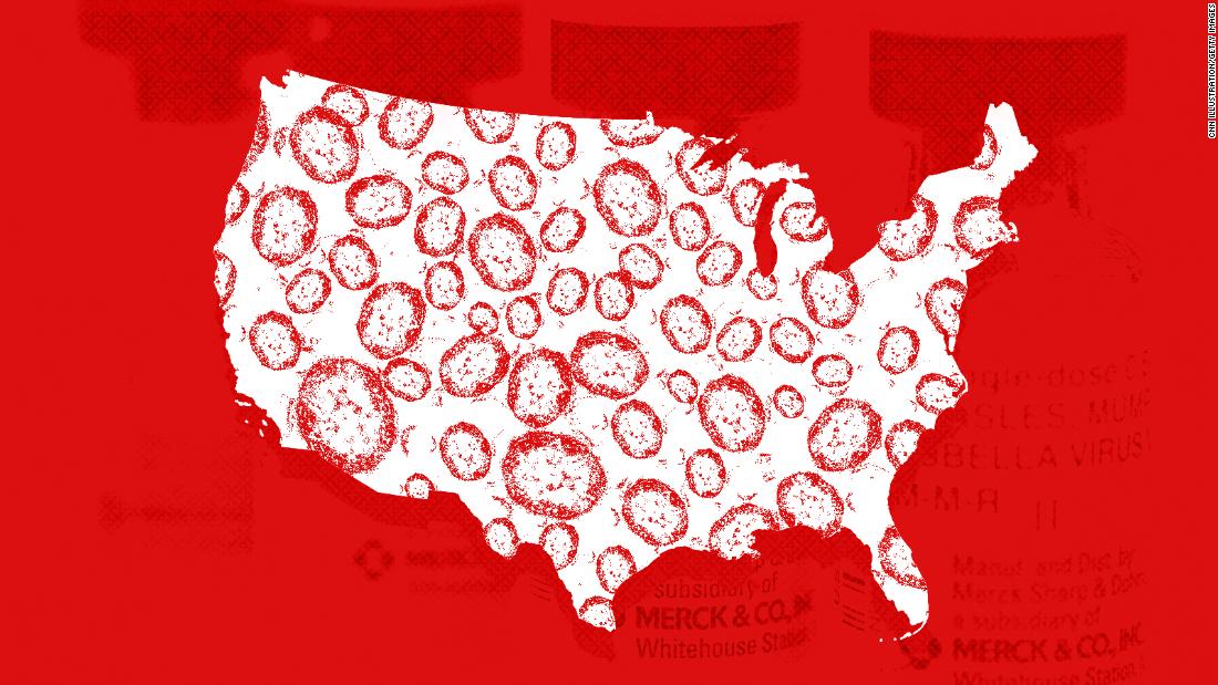 Understanding The Texas Measles Situation: Multiple Outbreaks, Rising Cases Understanding The Texas Measles Situation: Multiple Outbreaks, Rising Cases